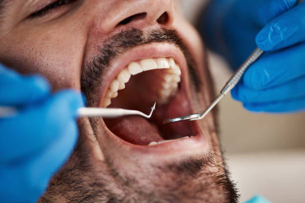Best Emergency Denture Repair in Weaverville, NC